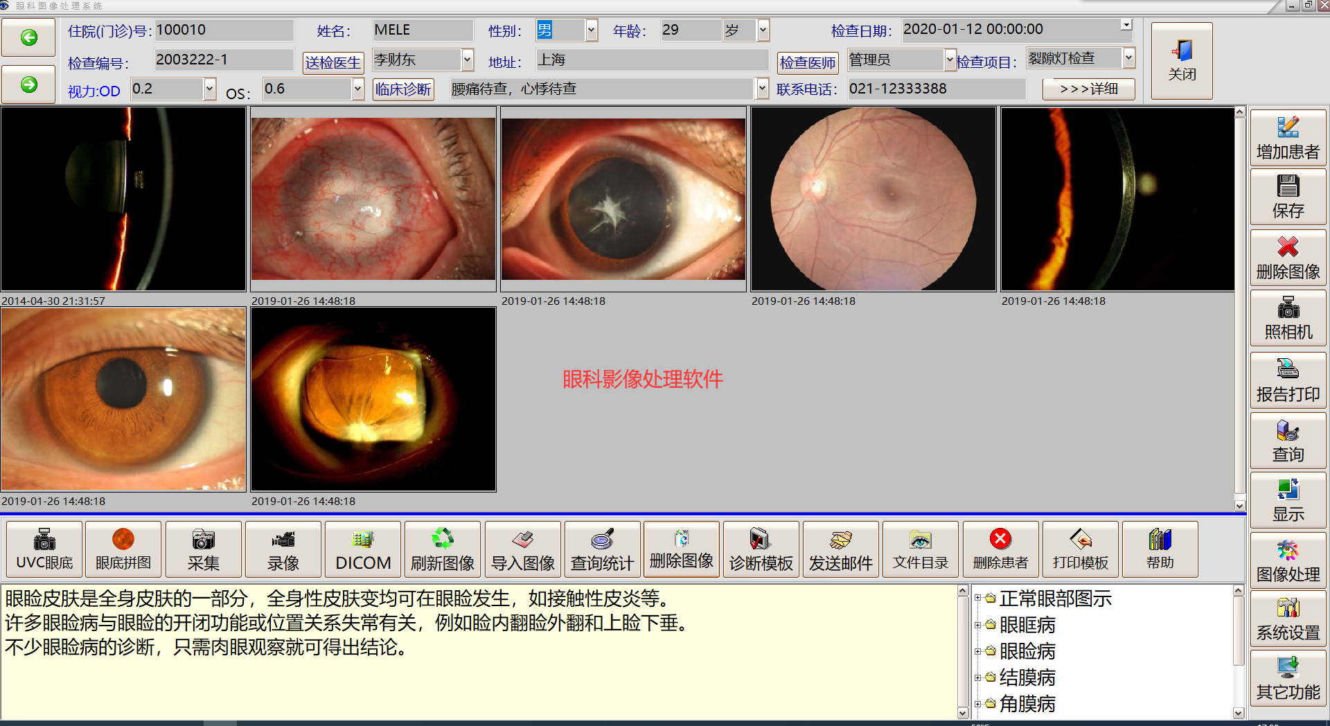 眼科图像处理软件